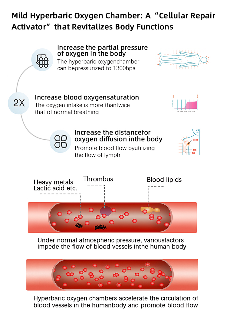 Single-Person Upright Hyperbaric Oxygen Chamber (Soft Chamber)